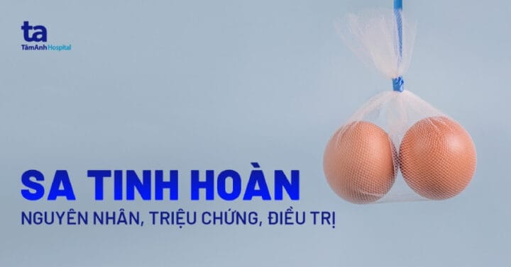 Nam giới tìm hiểu về tình trạng sa tinh hoàn và sức khỏe sinh sản